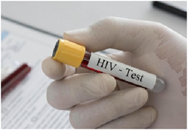 Có thể chữa khỏi HIV nhờ phương pháp điều trị mới