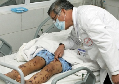 Cách ly 27 người có tiếp xúc với bệnh nhân viên não mô cầu tại Hà Nội