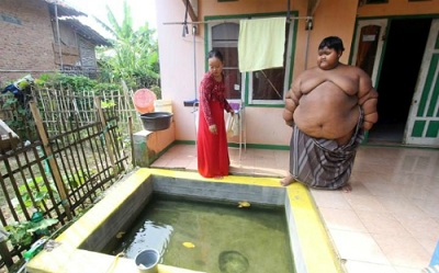 Indonesia: Cậu bé 10 tuổi nặng 190 kg