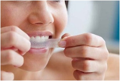 Cẩn trọng khi dùng miếng trắng răng sau một tuần