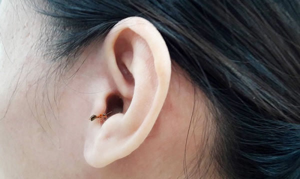 Cách xử trí chuẩn khi bị côn trùng chui vào tai